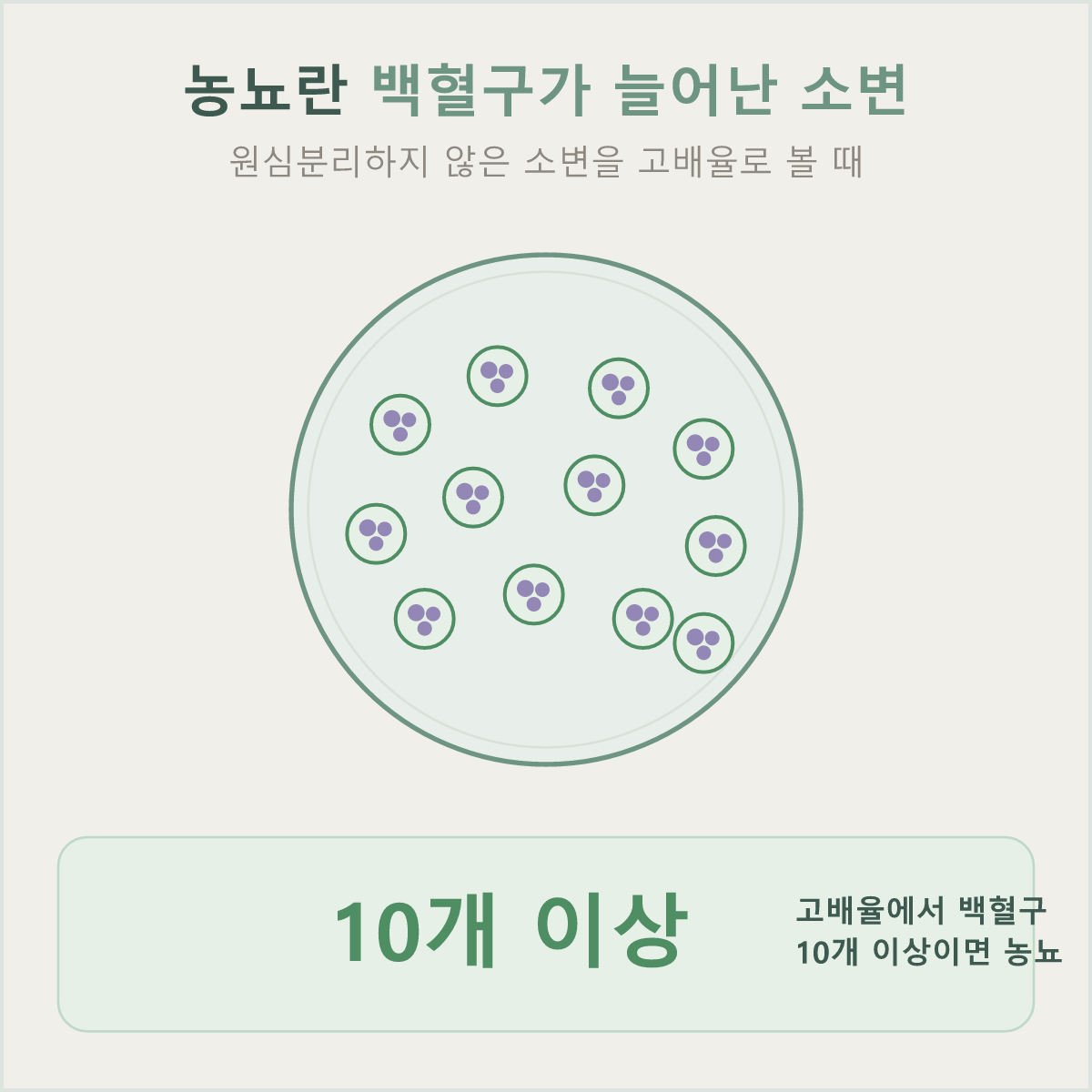 원심분리하지 않은 소변을 고배율로 볼 때 백혈구가 10개 이상이면 농뇨