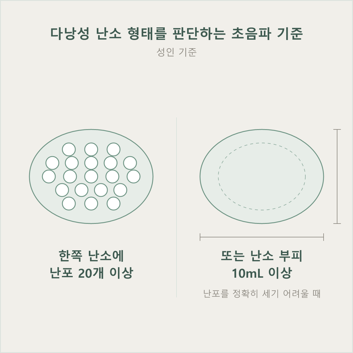 성인 기준 한쪽 난소에 난포 20개 이상이면 다낭성 형태로 보는 초음파 소견