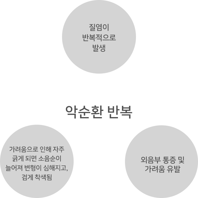 소음순 비대 방치 시 악순환 — 질염 반복·외음부 통증·가려움·변형·착색